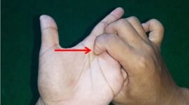 Cara Atasi Sakit Batuk Berdahak dengan Pijat Refleksi (Sumber Foto : Sholam)