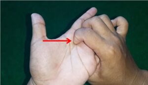 Cara Atasi Sakit Batuk Berdahak dengan Pijat Refleksi